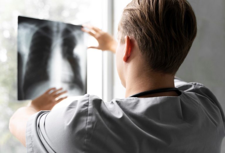 Sabe o que é Fibrose Pulmonar Trofa Saúde