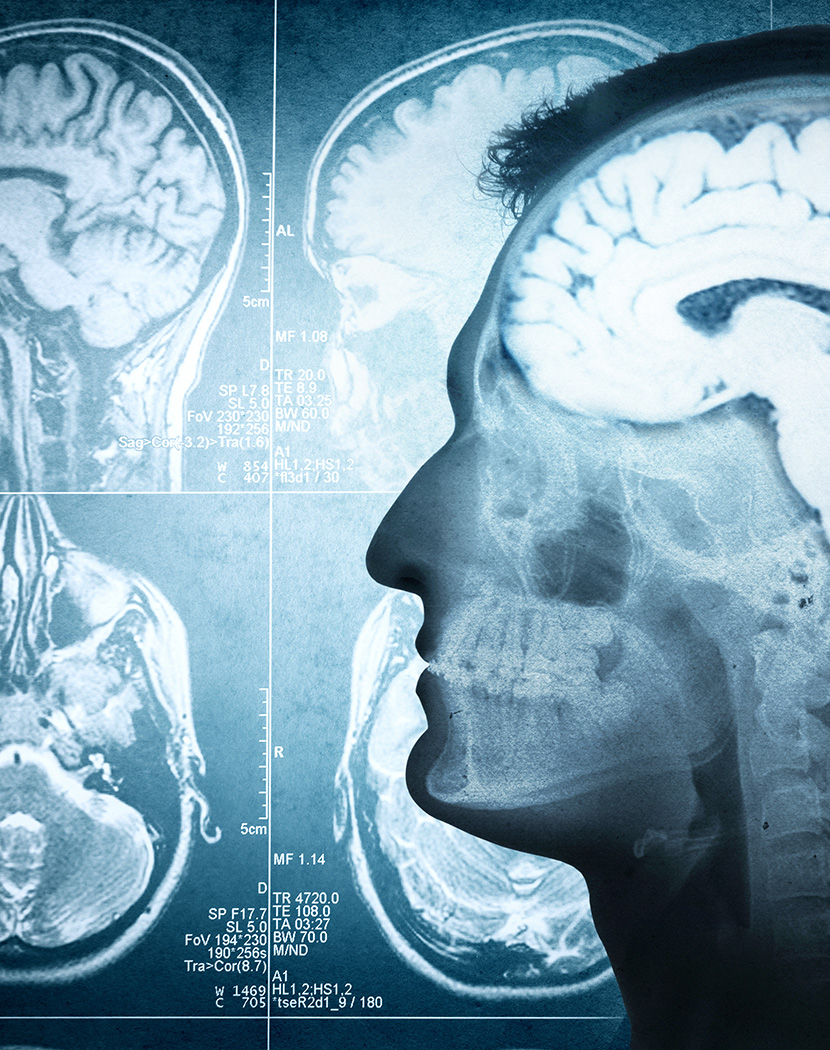 O futuro da neurocirurgia é fazer com que seja desnecessária» - Saúde e  Medicina - SAPO Lifestyle